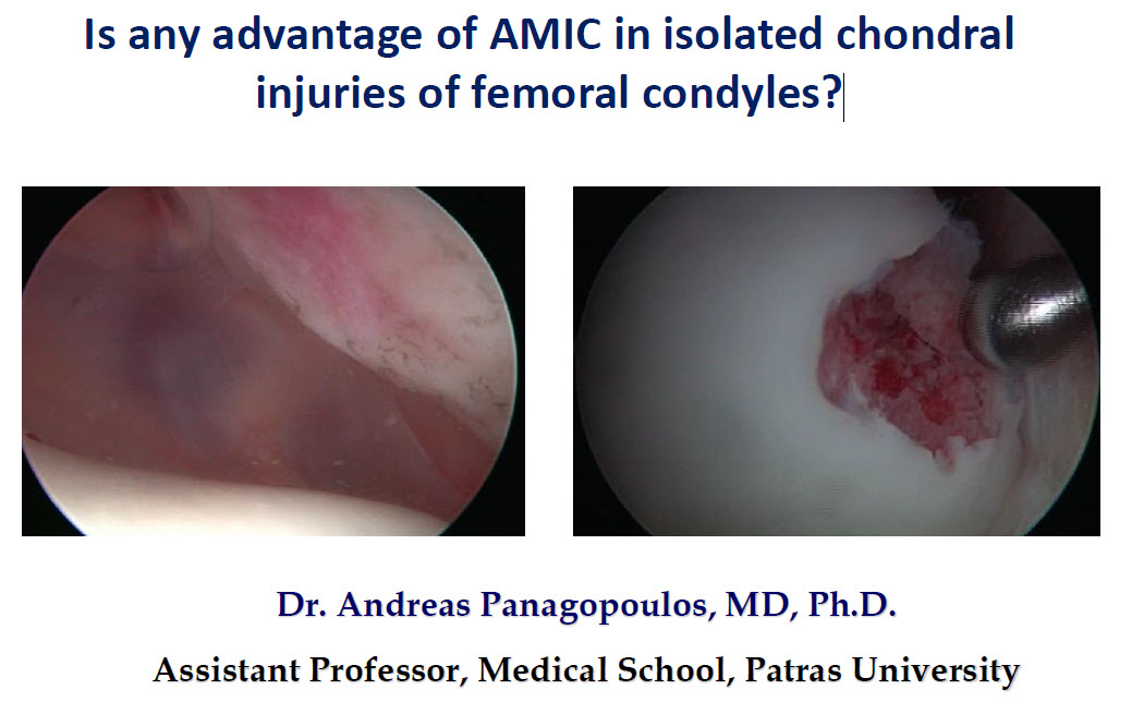 Is any advantage of ΑMIC in isolated chondral injuries of femoral condyles